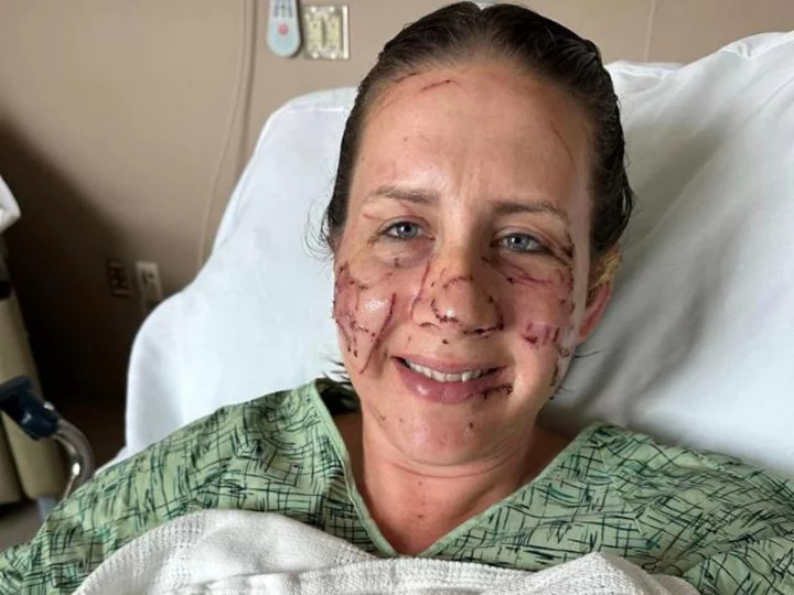 Woman attacked by 'vicious' otter: 'I did not think I was going to make it out of that river'