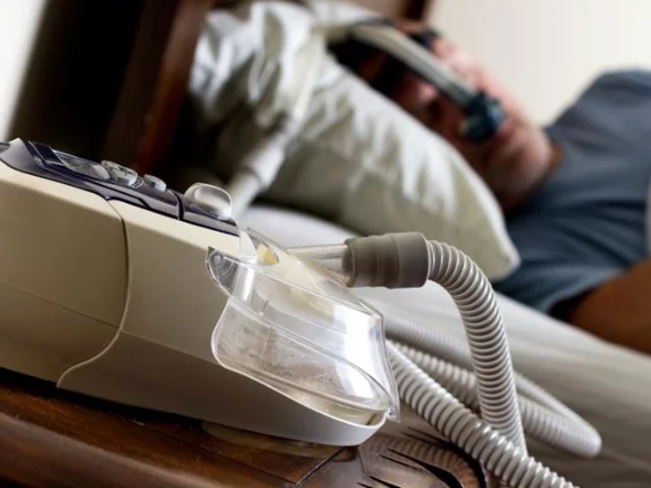 Sleep apnea raises risk of long Covid by up to 75% for some, study says